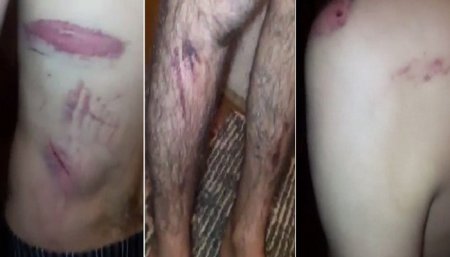 Տեսանյութեր. Սևանի «Տոտո» բուքմեյքերական կետում ոստիկանները դաժան ծեծի են ենթարկել Արա Մուրադյանին